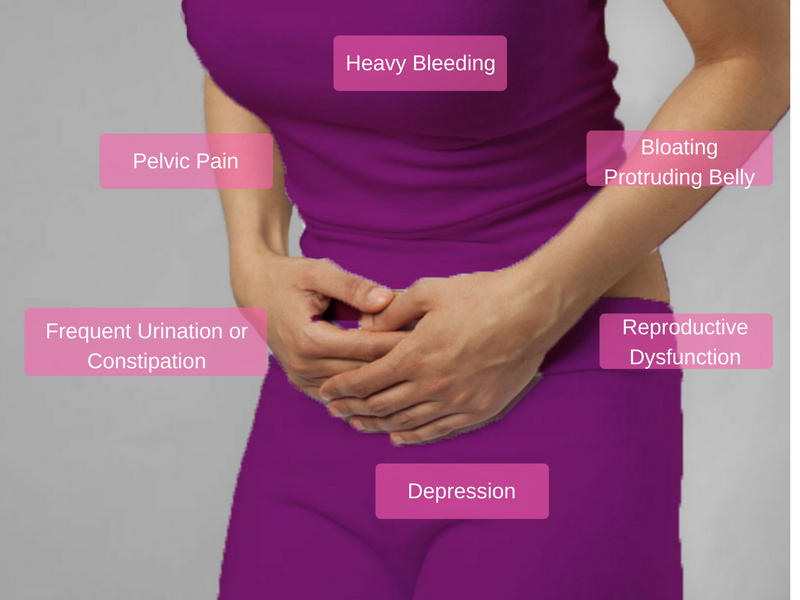 Find Out If You Are Suffering From Fibroids