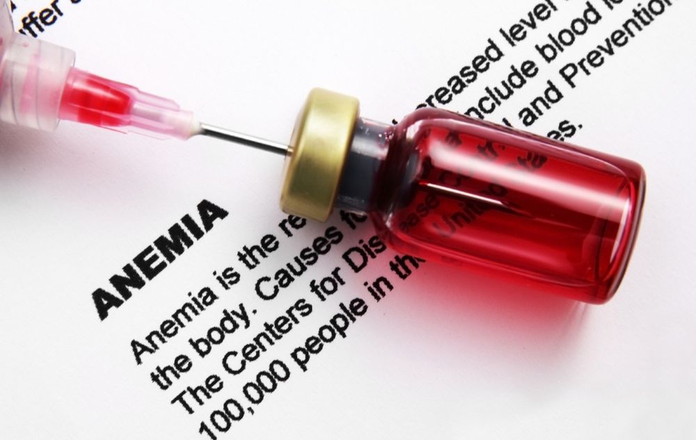 fibroids and anemia