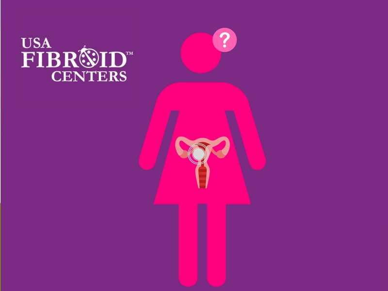 Fibroids: Are You Looking For Answers?