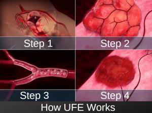 Visual Photo of how UFE Works