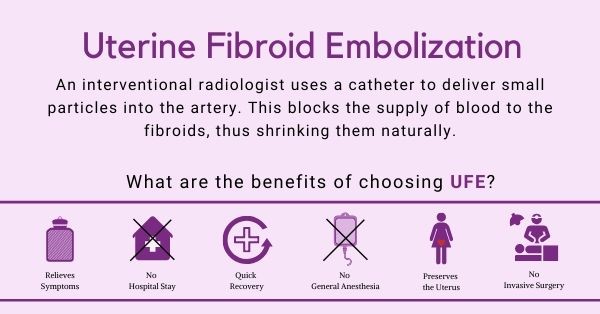fibroid doctor