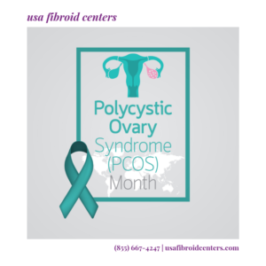 Key Differences Between PCOS and Uterine Fibroids