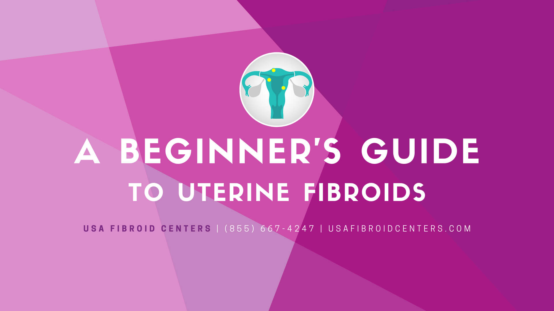 A beginner's guide to uterine fibroids.
