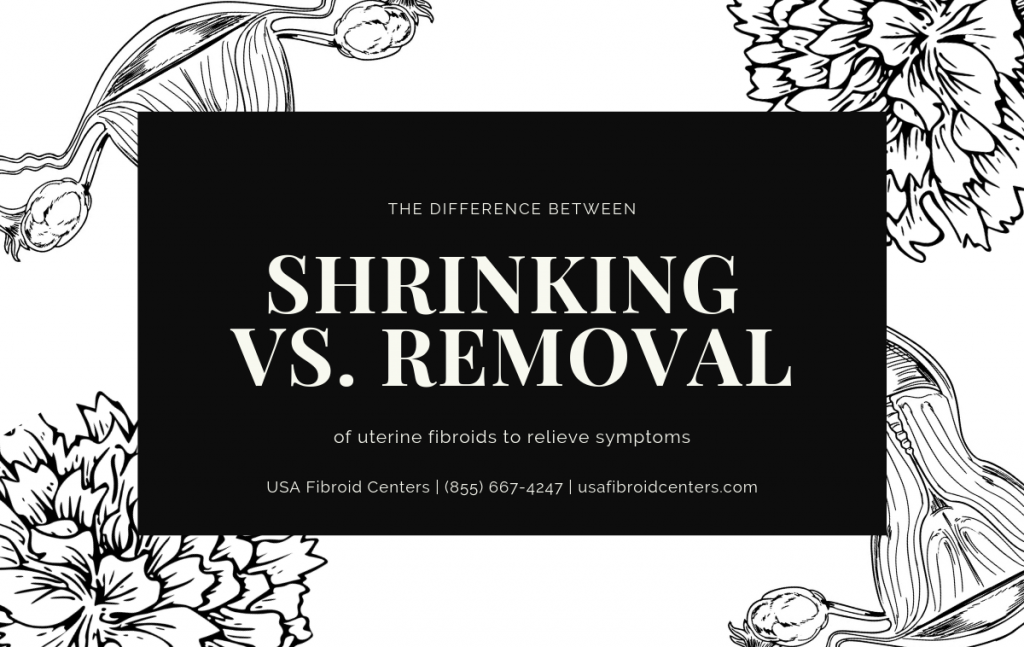 Shrinking vs. removal of uterine fibroids