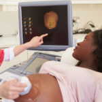 Conceiving with Fibroids