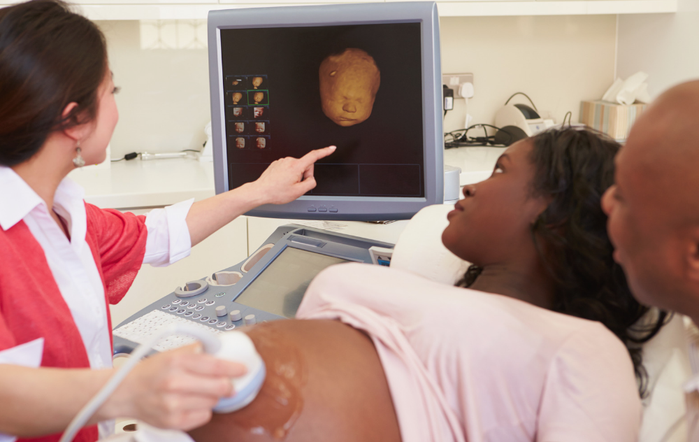 Doctor performing ultrasound on a woman
