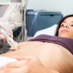 Fibroid Mapping with Minimally Invasive Technology