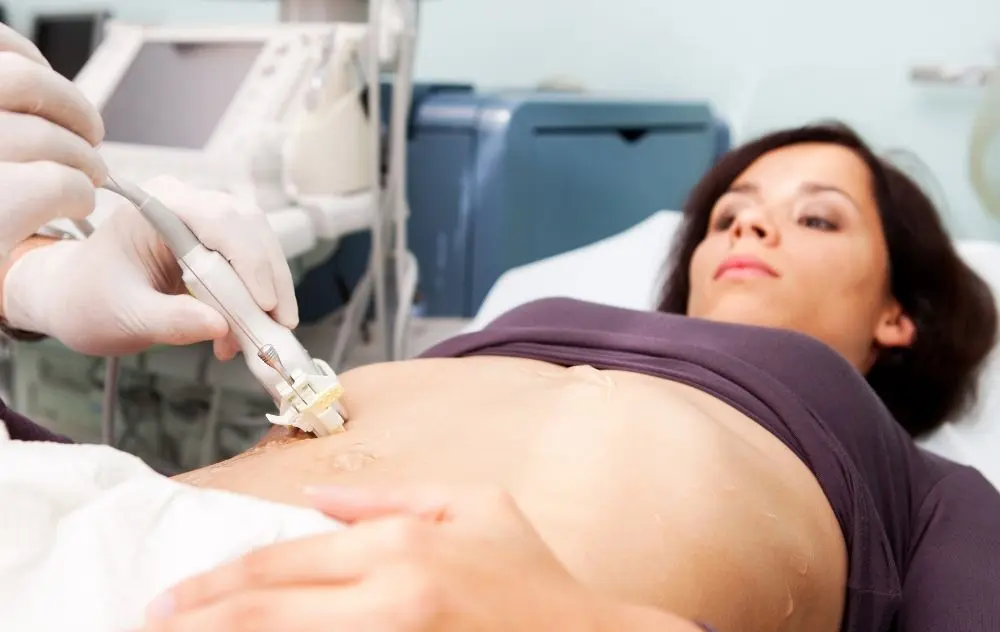 What Is Fibroid Mapping? 1 Fibroid Mapping with Minimally Invasive Technology