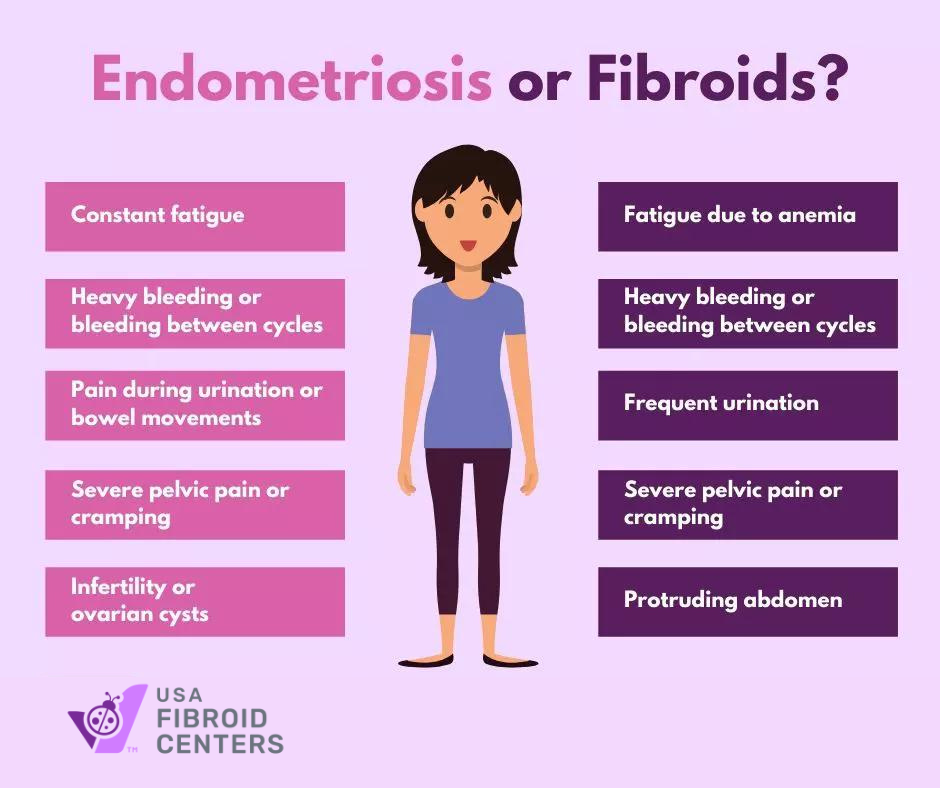 symptoms of endometriosis vs. symptoms of fibroids
