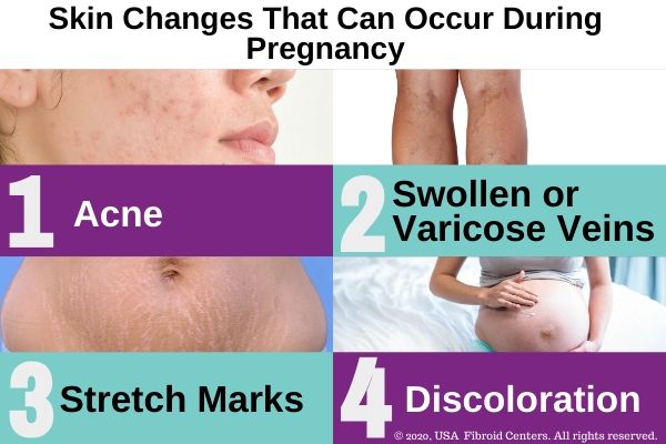Skin Changes that Can Occur During Pregnancy