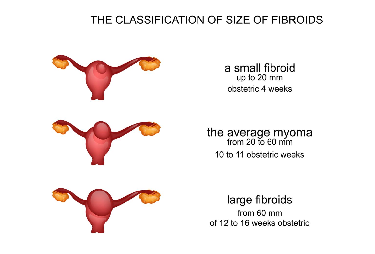 A Visual Guide To Fibroid Sizes USA Fibroid Centers