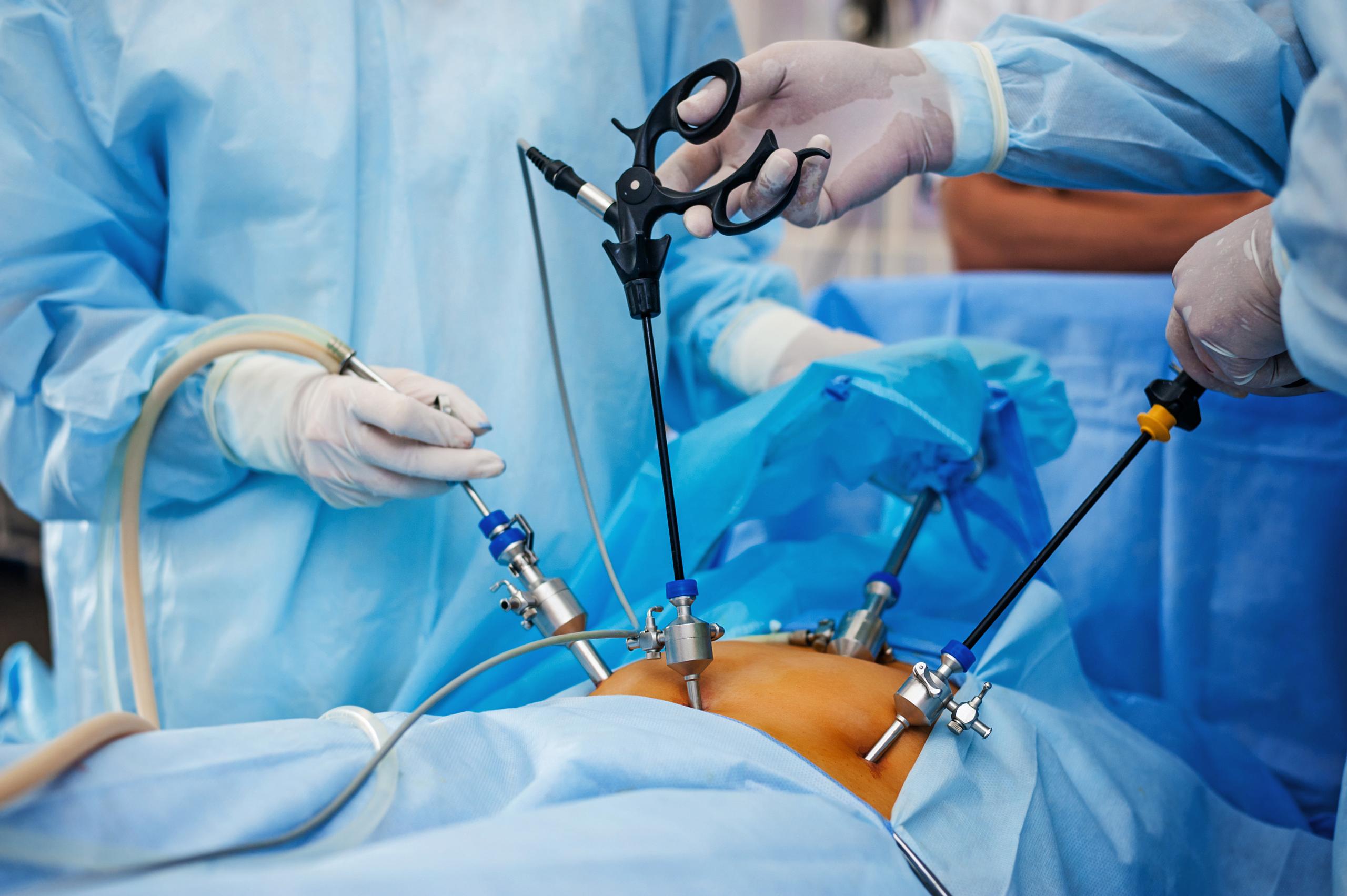 How Long Does It Take To Recover From A Myomectomy? 1 Myomectomy procedure