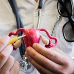 Doctor explaining Uterine Artery Embolization, also known as uterine fibroid embolization