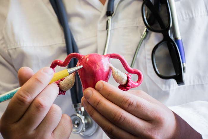 Doctor explaining Uterine Artery Embolization, also known as uterine fibroid embolization