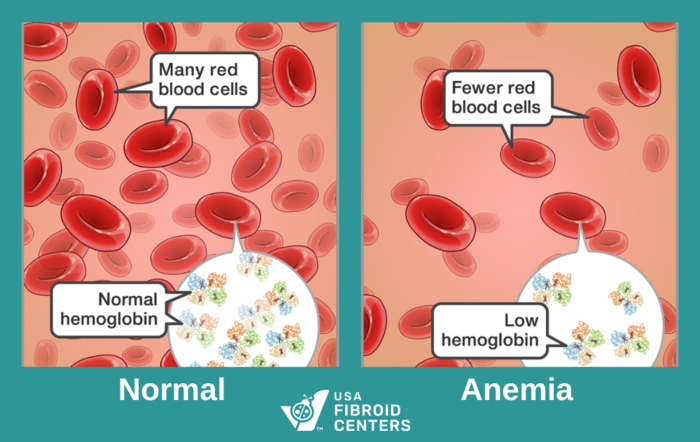 normal blood vs anemic blood