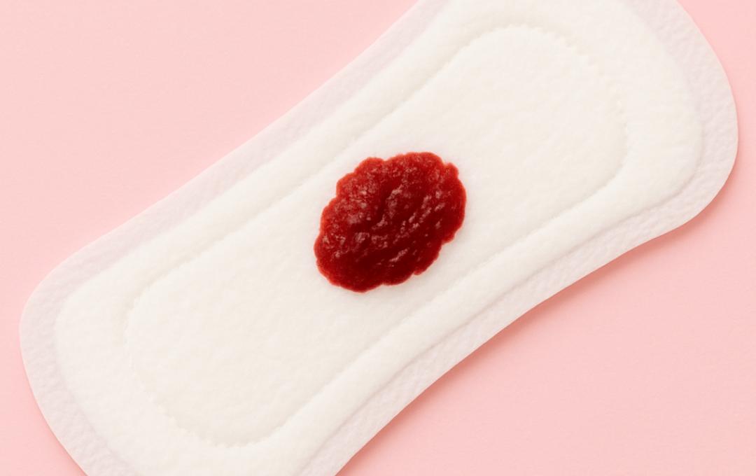 Blood Clots During Period: What’s Normal, What’s Not, and When to See a Specialist