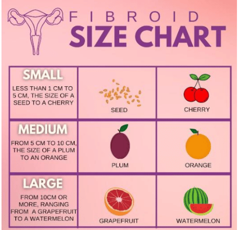 Fibroids and Uterine Enlargement