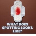 What does spotting looks like?