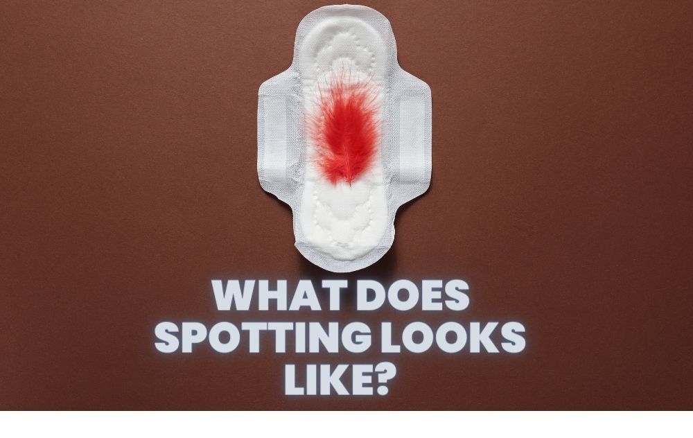 What does spotting looks like?
