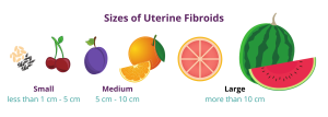 Sizes of uterine fibroids