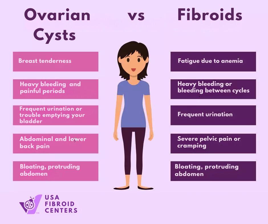 Can Ovarian Cysts Cause Lower Back Pain?