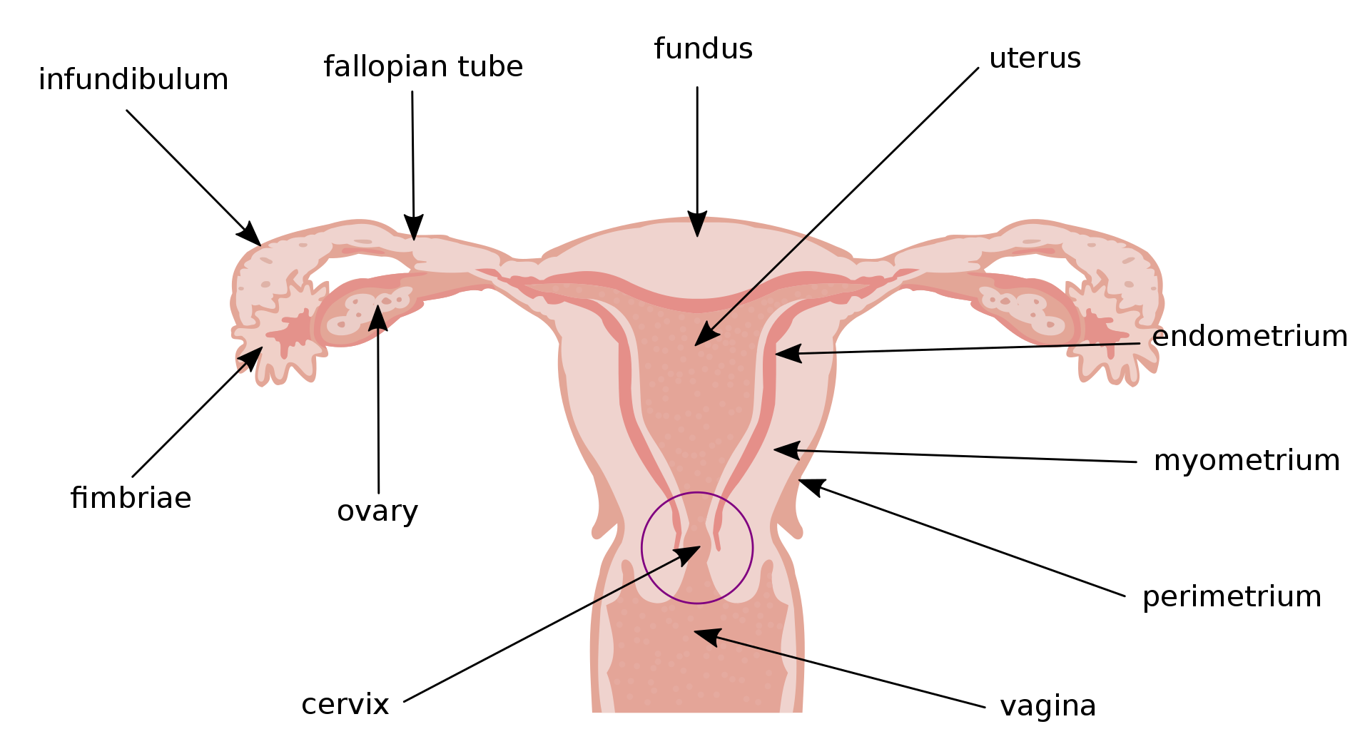 Stockvector Female Uterus Biopsy Surgical Ovary Tubal Cyst Pelvic