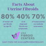 Usa Fibroid Centers' Instagram Live: Your Fibroid Questions Answered! - 99o0d79
