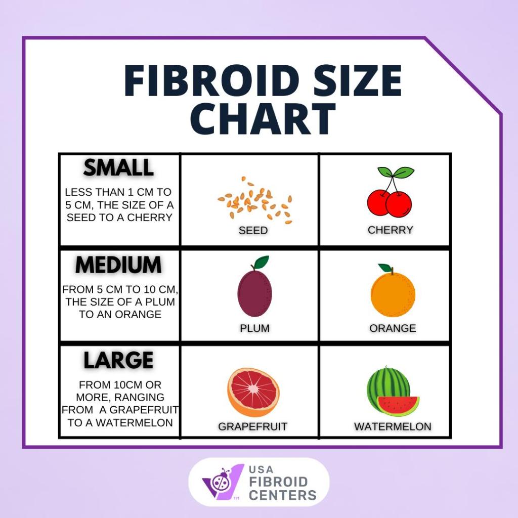 does-ufe-work-on-large-fibroids-usa-fibroid-centers