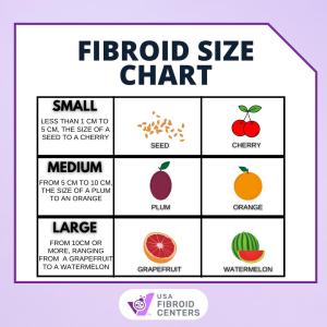 ufe for large fibroids