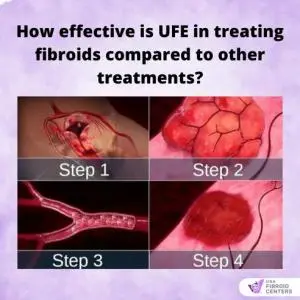 How Successful Is Ufe? 4 UFE Steps to shrink fibroids