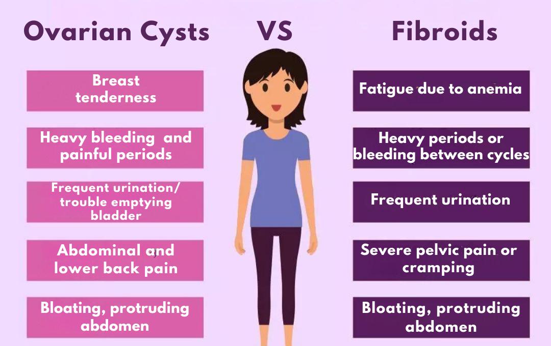 Ovarian Cysts vs Fibroids