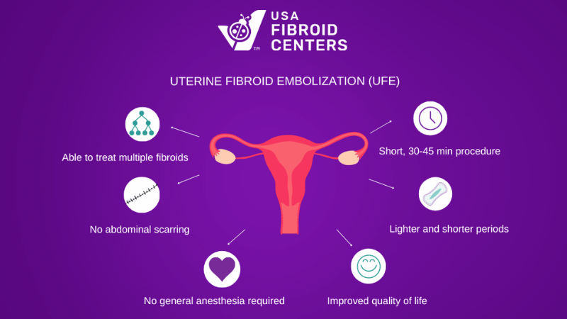 Uterine Fibroid Embolization Treatment Graphic