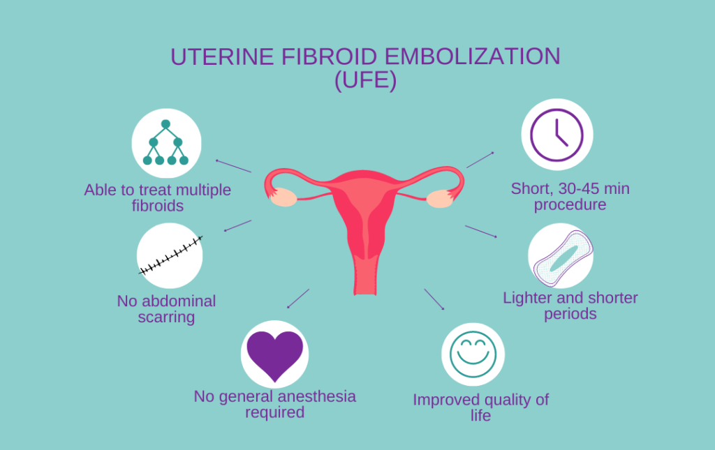 Benefits of UFE