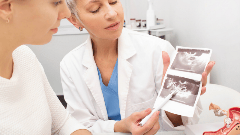 diagnosing Untreated Fibroids