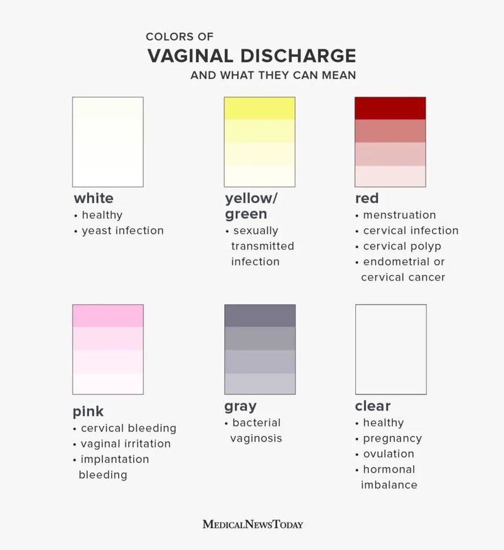colors of vaginal discharge