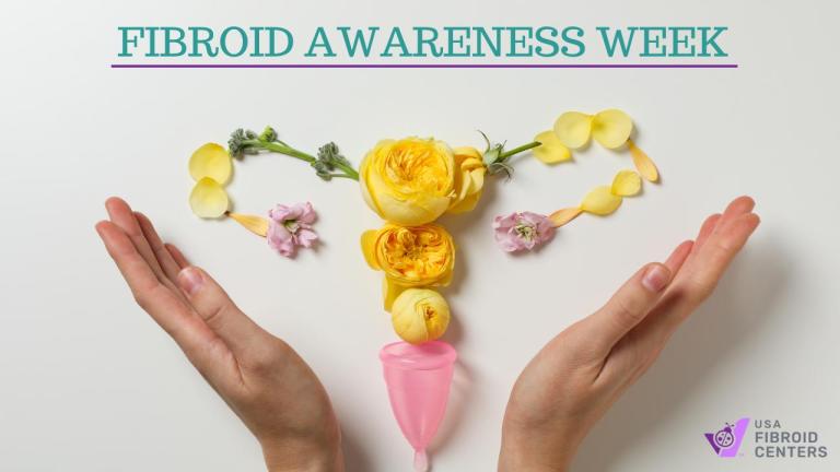 Fibroid Treatment Revolution: Usa Fibroid Centers' Instagram Live - ol18sh7