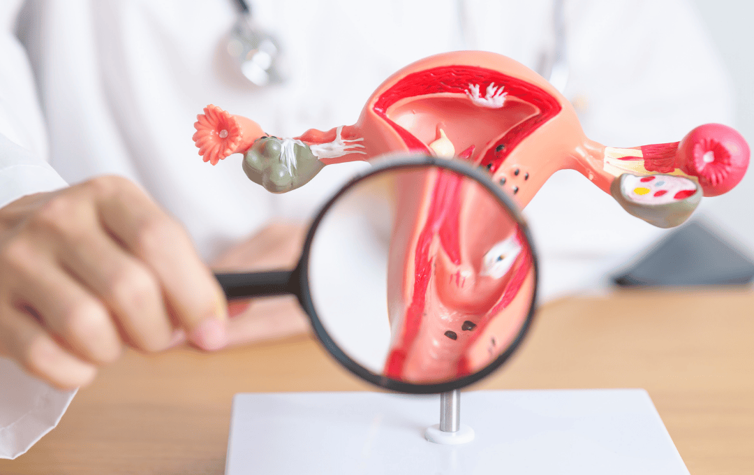 Signs of Fibroids Breaking Down