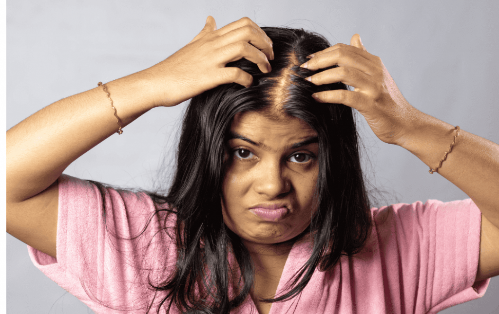 Can Fibroids Cause Hair Loss?