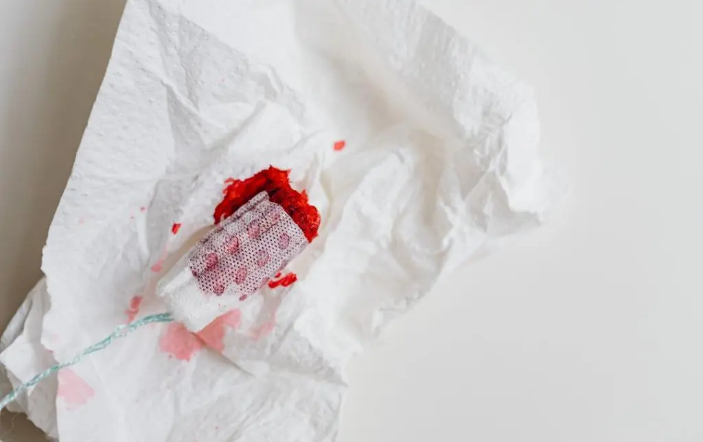 Can Uterine Fibroid Embolization Help With Menorrhagia? 4 Uterine Fibroid Embolization Help with Heavy Menstrual Bleeding (Menorrhagia)