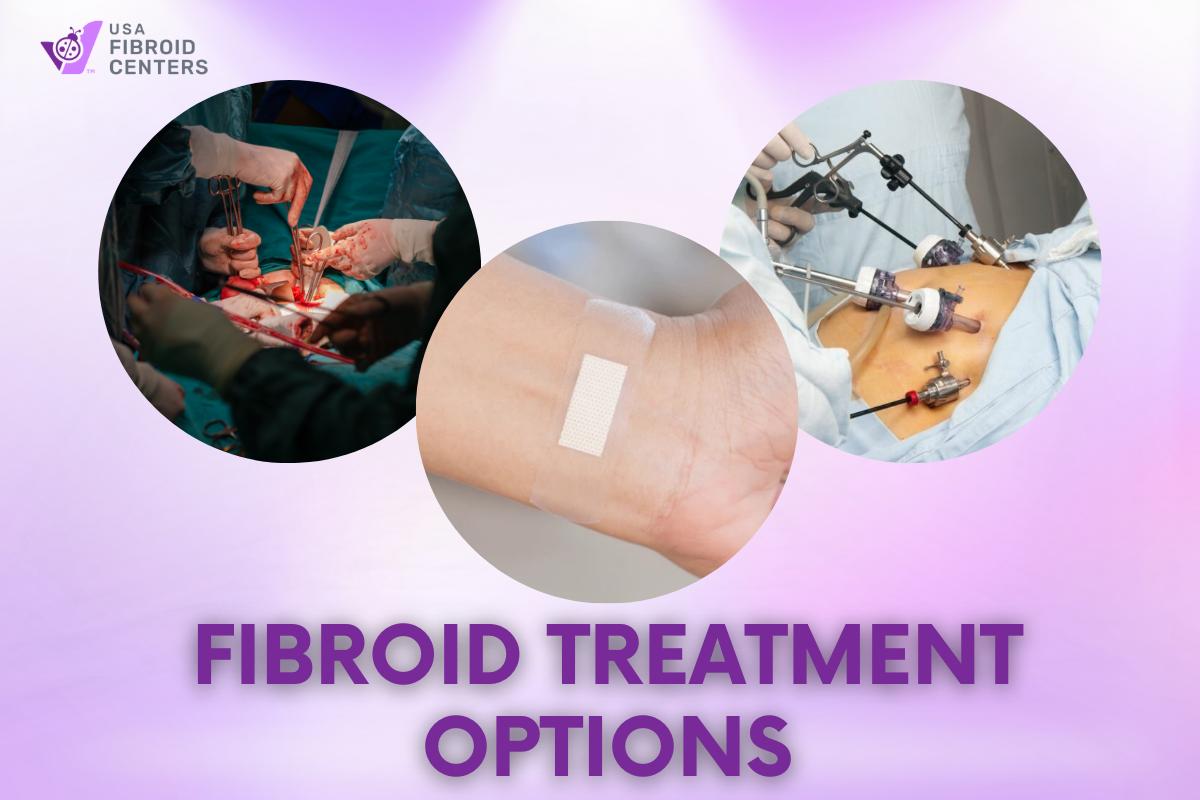 How Much Does Fibroid Treatment Cost? 1 How Much Does Fibroid Treatment Cost?