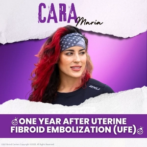 MTV Challenge Star Cara Maria's One Year After Uterine Fibroid Embolization (UFE)