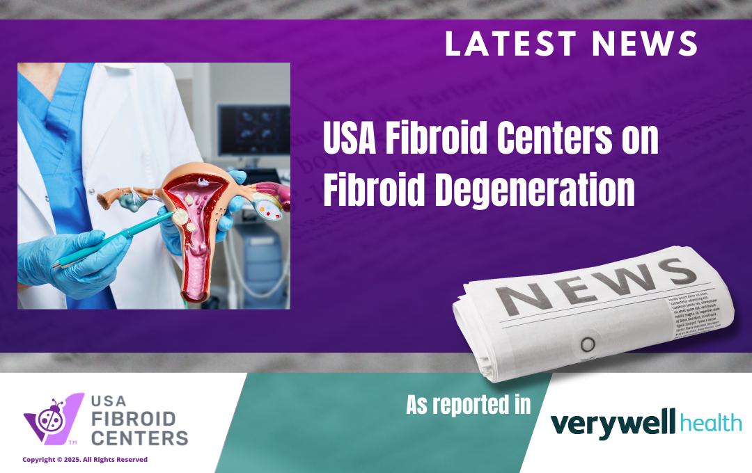 Usa Fibroid Centers Recognized By Verywell Health As Leading Expert On Fibroid Degeneration 1 USA Fibroid Centers expertise cited in VeryWell Health article on Fibroid Degeneration