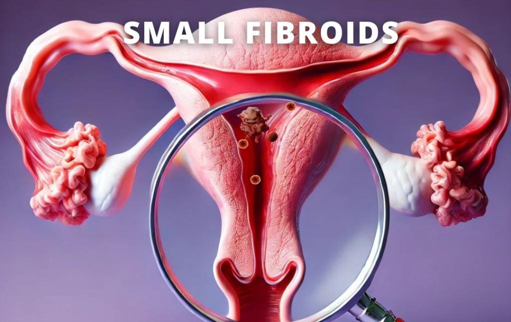 Do Small Uterine Fibroids Still Need Treatment?
