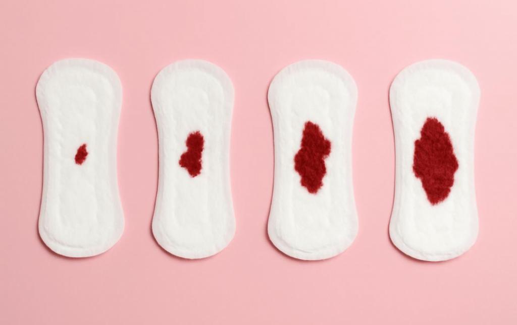 What Does Spotting Look Like?