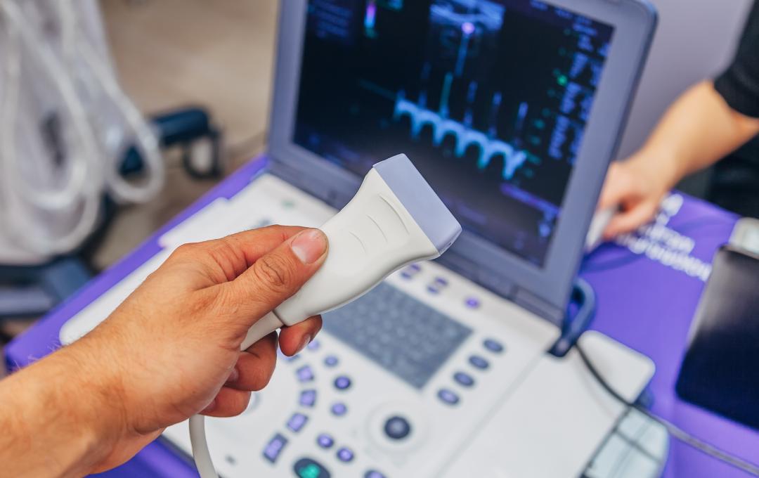 Can You Have Both Fibroids And Cysts? 4 Your paragraph text 23