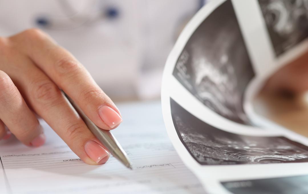 Fibroid Vs. Polyps: What’s The Difference? 6 A fibroid specialist reviewing ultrasound imaging, scans and reports of a patient to get diagnosis.