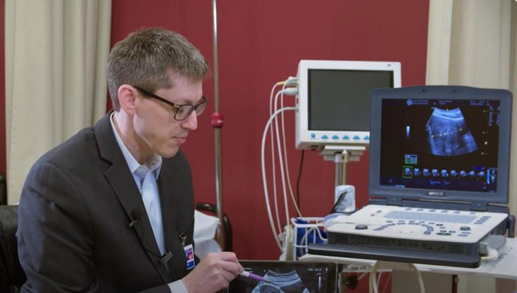 Is There A Drink That Can Help Shrink Fibroids? 7 Doctor Explaining UFE