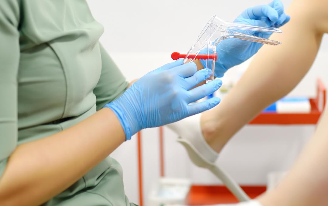 Common Questions About The Detection Of Fibroids 2 Doctor preparing for a patient's pap smear.