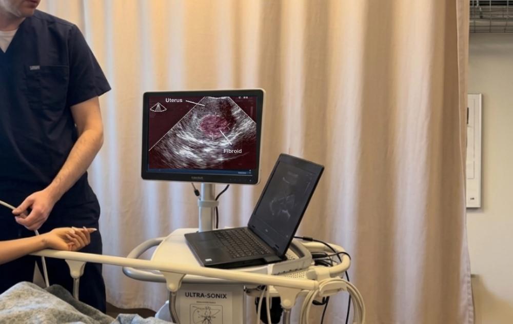 Pictures Of Fibroids 5 Doctor showing fibroid picture on ultrasound imaging