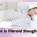 What Is Fibroid Sloughing?